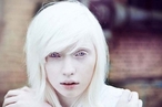 Биологи обнаружили белок, вызывающий альбинизм