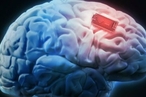 В мозг человека вживили улучшающее память устройство