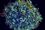 Ретиноевую кислоту назвали спасением от ВИЧ