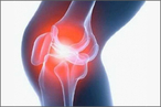 Новая технология по лечению травм колена