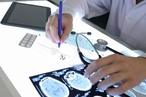 Российские ученые выяснили, как можно вылечить височную эпилепсию