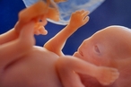 В России запретили создавать эмбрион человека ради производства биоматериала