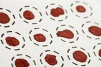 Метод «сухой капли» расширит возможности анализа крови
