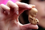 В Великобритании разрешили модифицировать эмбрионы человека