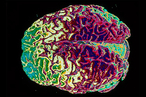 Биоинженеры создали трехмерную работающую ткань мозга